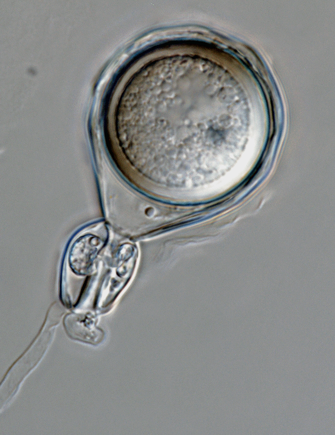 Phytophthora agathidicida nbsp;(ex-type CPHST BL 154) sexual phase formed on hemp seed agar: oogoniumnbsp;with wavy wall and tapered base,nbsp;amphyginous antheridium,nbsp;and plerotic, thick-walled oospore; photonbsp;by G.Abad, USDA-APHIS-PPQ.